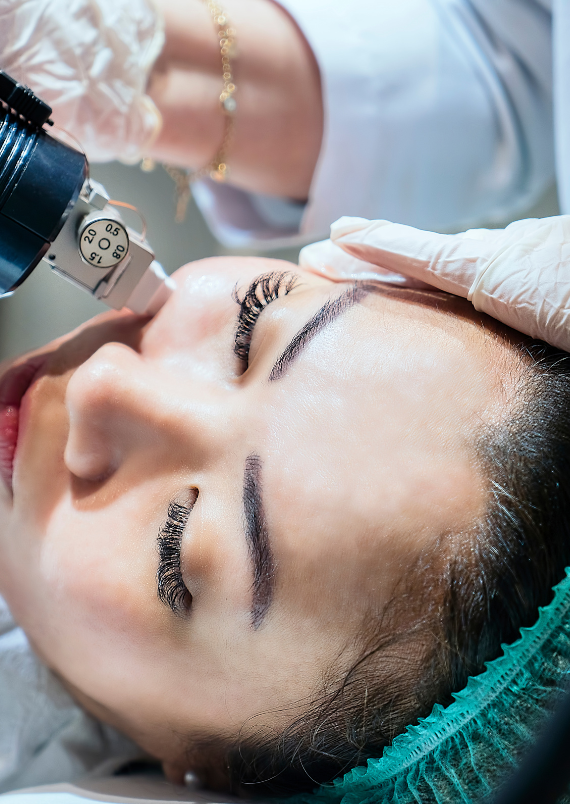 Microneedling And Microdermabrasion