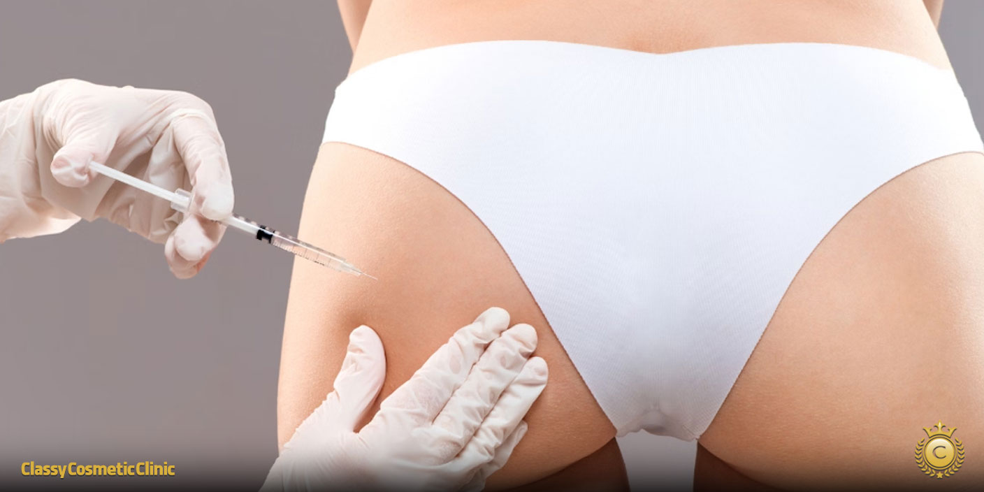 Buttock Filler Injections: A Complete Guide to Benefits, Risks, and Post-Care