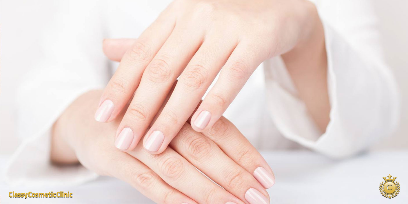 Hand Rejuvenation with Filler Injections 