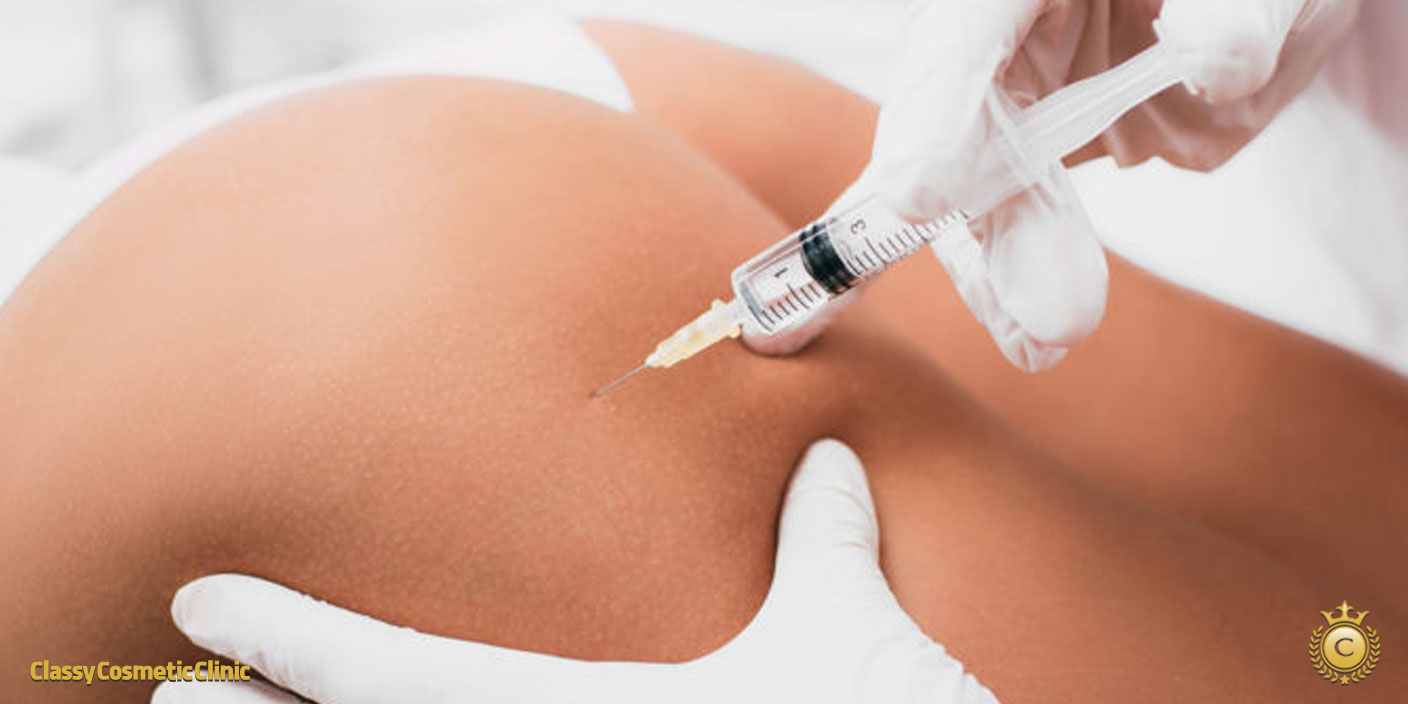 Buttock Filler Injections: A Complete Guide to Benefits, Risks, and Post-Care