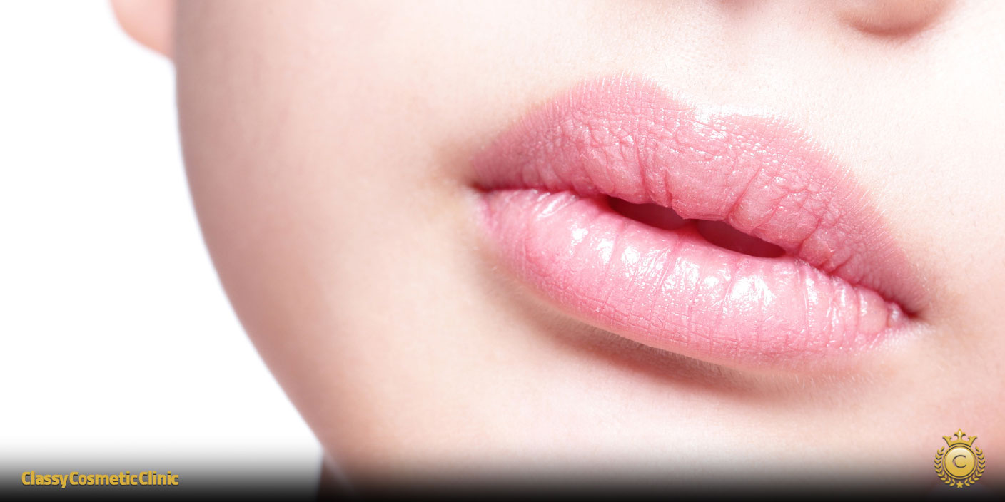 Ultherapy Perioral: A Non-Surgical Solution for Mouth Wrinkles and Sagging Skin