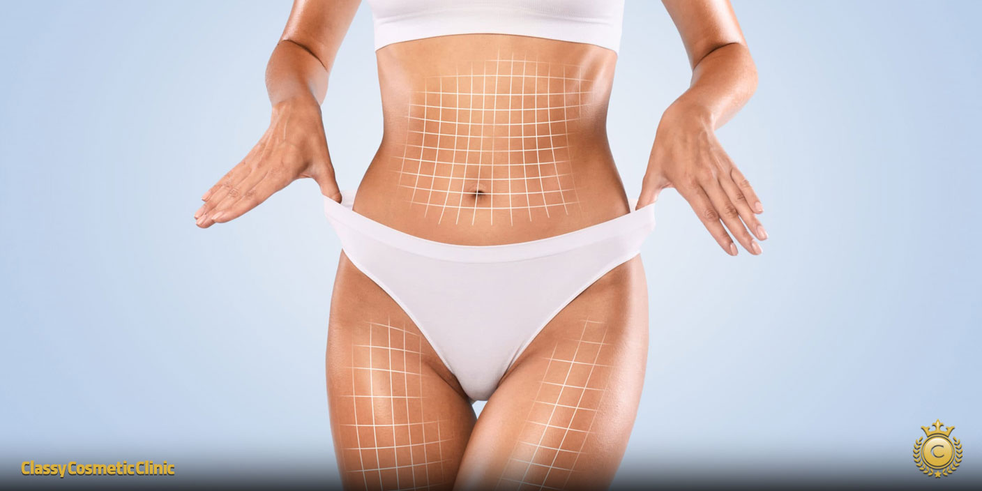 What Is Body Contouring? Safe & Effective Methods for the Perfect Shape