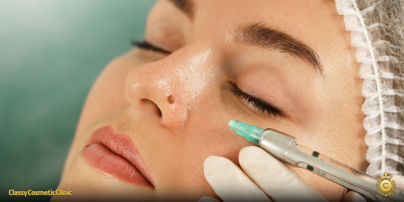 Get Rid of Moles on Your Face Forever: Long-Lasting Clinical Methods That Work